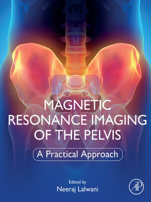 cover image of Magnetic Resonance Imaging of the Pelvis